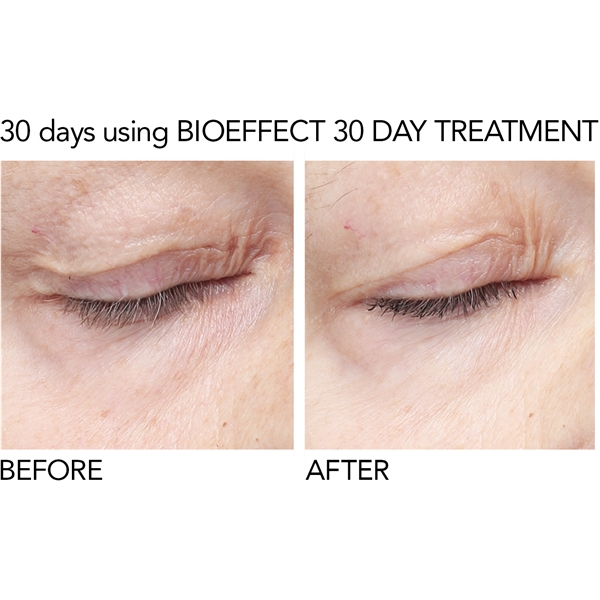 BioEffect 30 Day Treatment (Billede 4 af 8)