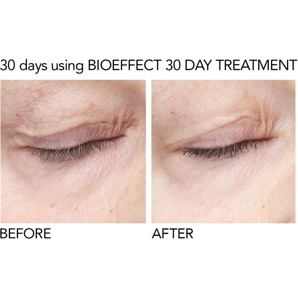 BioEffect EGF Eye Serum (Billede 4 af 10)