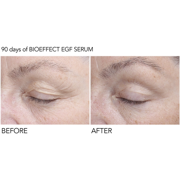 BioEffect EGF Eye Serum (Billede 5 af 10)