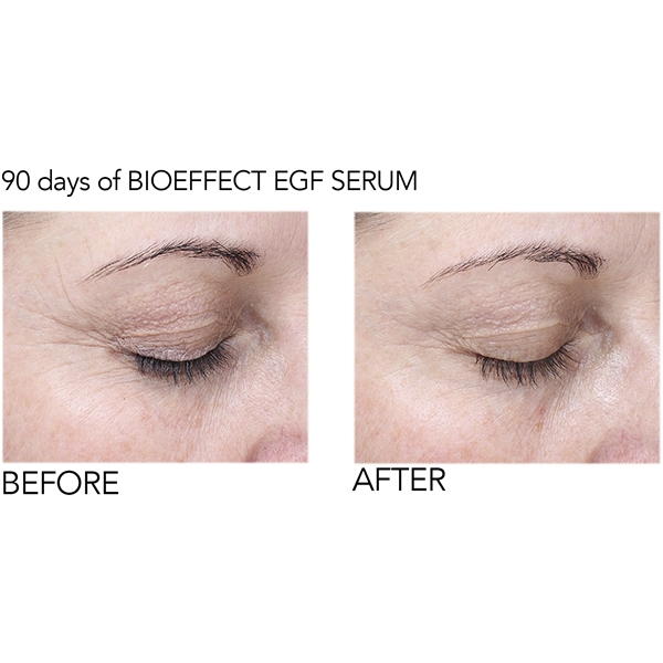 BioEffect EGF Eye Serum (Billede 6 af 10)