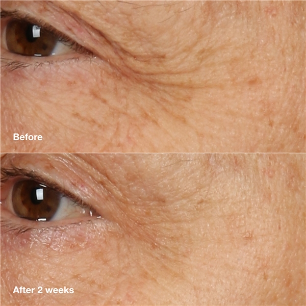 Smart Clinical Repair Overnight Cream + Mask (Billede 3 af 10)