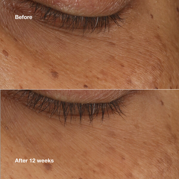 All About Eyes Brightening Serum Concentrate (Billede 2 af 10)