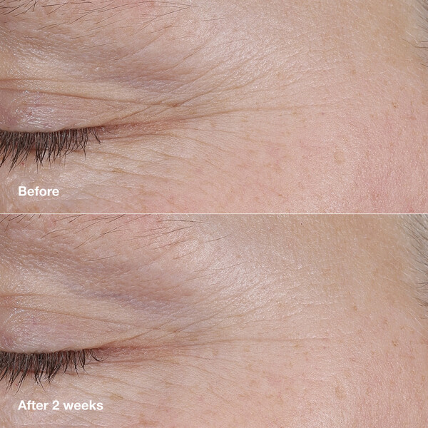 Smart Clinical Repair AM/PM Retinoid Balm (Billede 5 af 8)