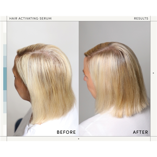 M2 Beauté Hair Activating Serum (Billede 4 af 5)