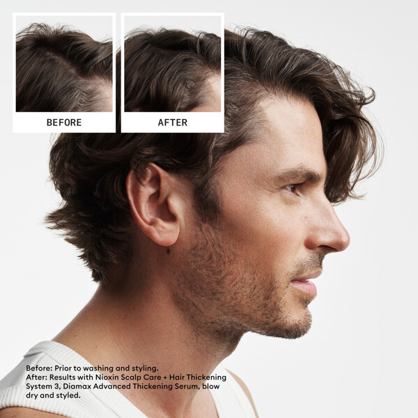 Hair System Kit 2 (Billede 2 af 6)