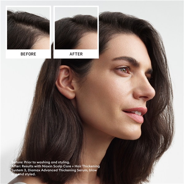 Hair System Kit 3 (Billede 2 af 6)