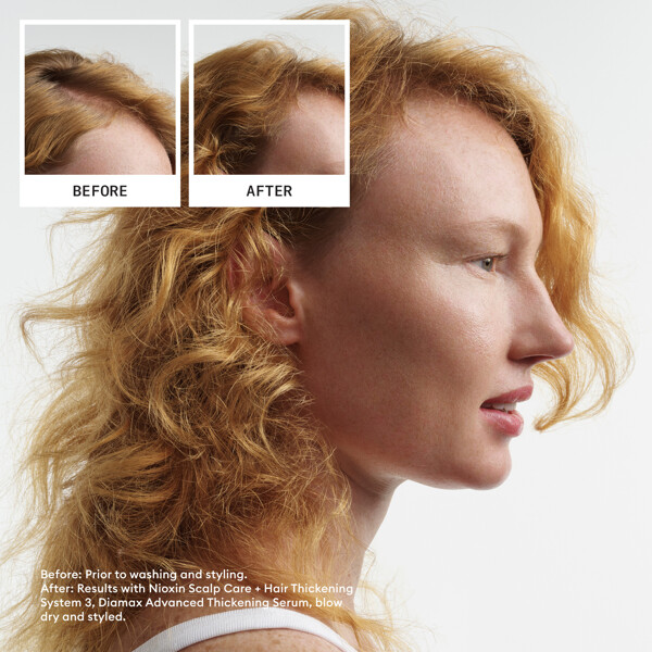Hair System Kit 4 (Billede 2 af 6)