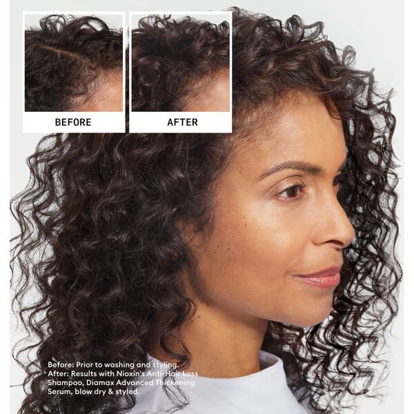Nioxin Anti Hair Loss Shampoo (Billede 2 af 6)