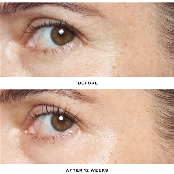 Transform Double Rewind 0,3% Retinol Serum (Billede 4 af 8)