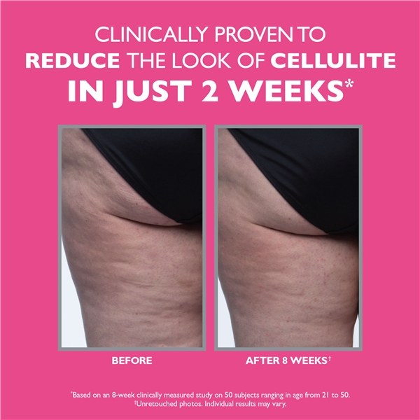 FIRMx® Tight & Toned Cellulite Treatment (Billede 5 af 9)