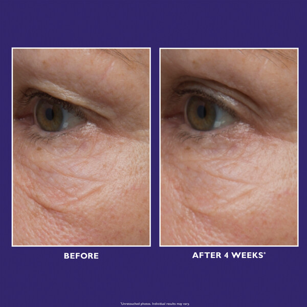 Ultimate Solution 5™ Eye Cream (Billede 4 af 8)