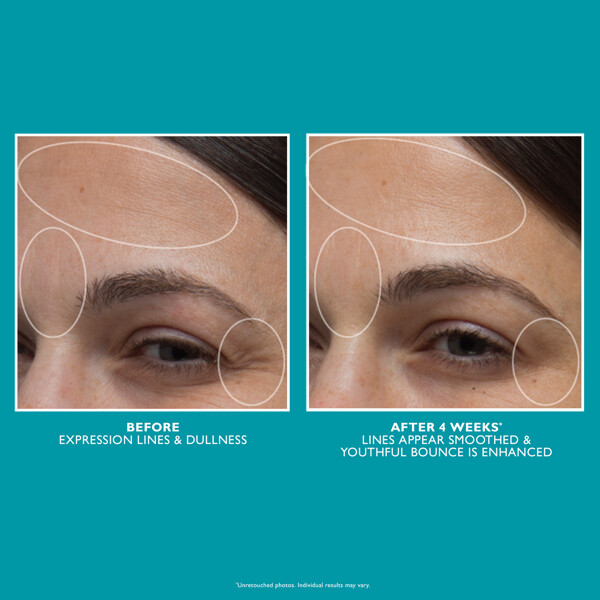 Peptide Skinjection Moisture Infusion Cream (Billede 3 af 3)