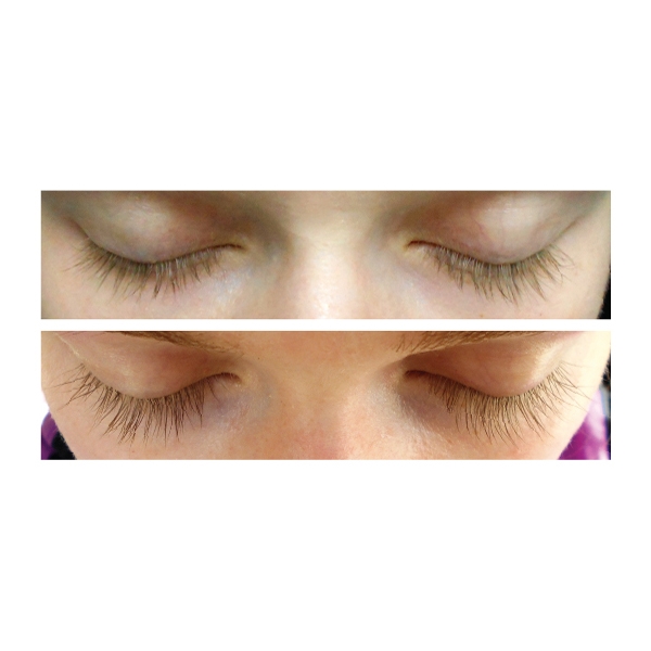 Xlash Eyelash Serum (Billede 2 af 2)